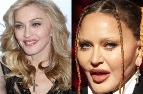 Looks Like It Hurts Madonnas New Face Shocks Fans Photos