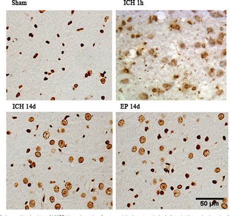 Figure From Effects Of High Mobility Group Box On Cerebral