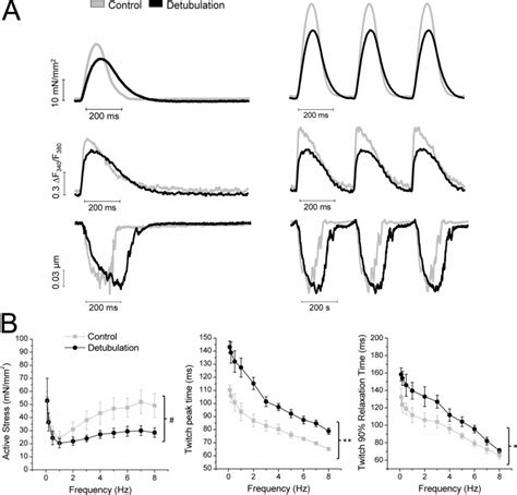 Mechanical Consequences Of Acute Detubulation In Ventricular