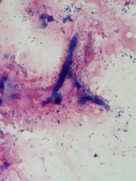 グラム陽性桿菌 Gpr グラム染色 Gram Stain