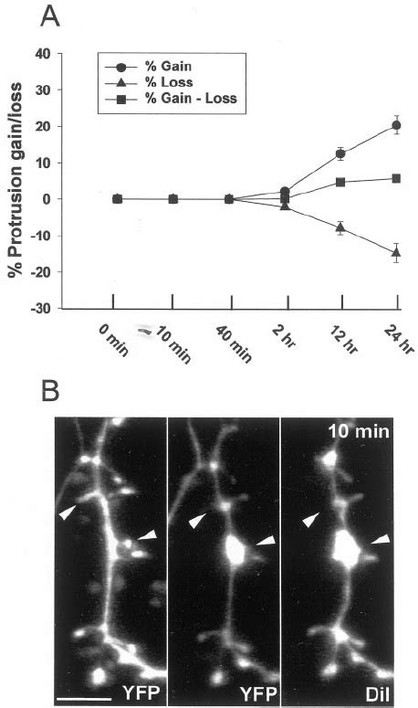 Protrusion Turnover And Nmda Induced Spine Loss Visualized With Yfp A