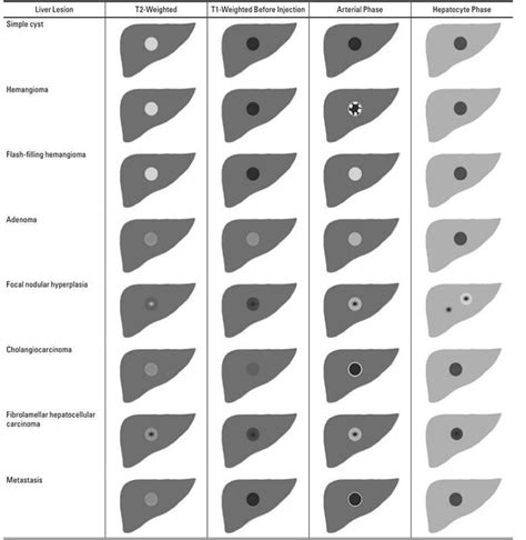 Typical Imaging Appearance Of Focal Liver Lesions Before And Medizzy