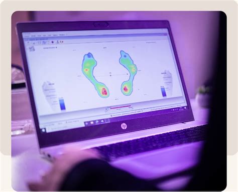 Hallux Valgus Oorzaken Symptomen En Behandelingen Podotherapie Hermanns