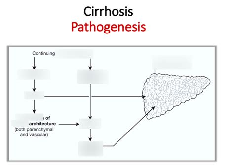 Diagram Of Cirrhosis Pathogenesis Quizlet