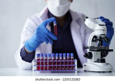 Lab Worker Preparing Test Blood Detection Stock Photo 2205132083