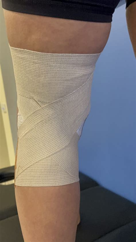 Knee Mcl Taping Strapup