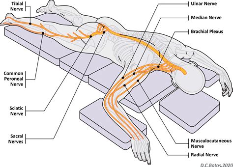 Imaging Review Of Peripheral Nerve Injuries In Patients With COVID 19