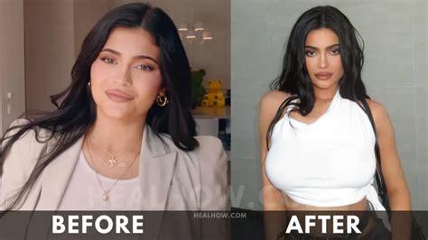 Kylie Jenner Weight Loss Before And After 2024