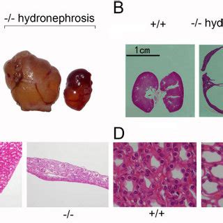 Renal Morphology Of UT B Null Mice A Gross Structure Of Kidneys From