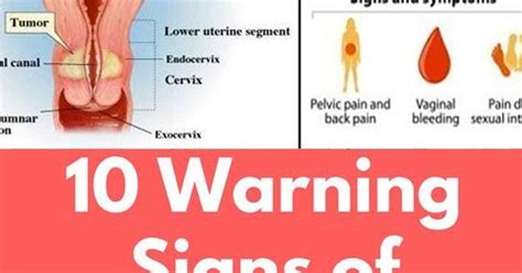 10 Warning Signs Of Cervical Cancer No Woman Should Ignore Hello Healthy