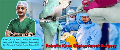 Revolutionizing Joint Surgery The Rise Of Fully Robotic Knee Replacement By Dr Anuj Jain