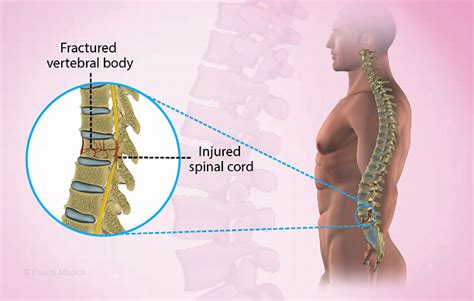 Health Condition : Symptoms, Causes, Treatment and More