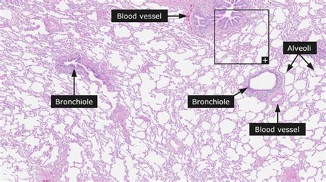 RESP Histology Flashcards Quizlet