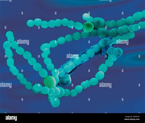 Farbige Scanning Electron Micrograph SEM Von Anabaena Sp Gram