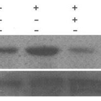 Effect Of PMA On Activation Of Rac1 In Glioblastoma Cells A Cells