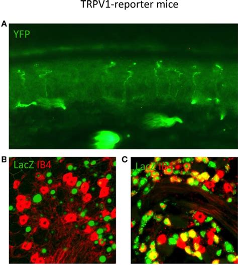 Trpv1 Reporter Mice Reveal The Anatomy Of Neurons That Expressed Trpv1