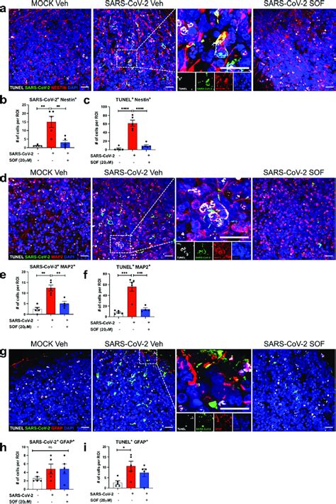 Sars Cov Impact On Different Brain Cell Types A D G Immunolabeling