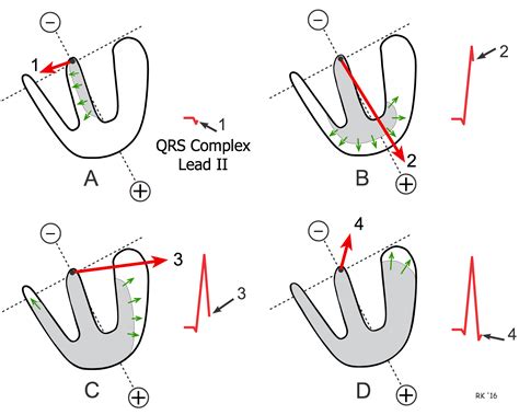 Cv Physiology Ventricular Depolarization And The Mean Electrical Axis