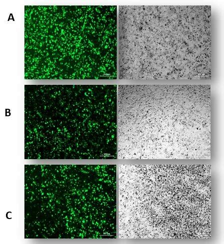 Optimization Of Gfp Transfected Cells In Hek A Tt B