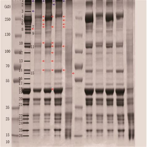 Sds Page Patterns Of Proteins From Different Pork Products Samples