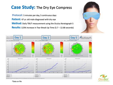 Dry Eye Compresses — Ocusci Inc