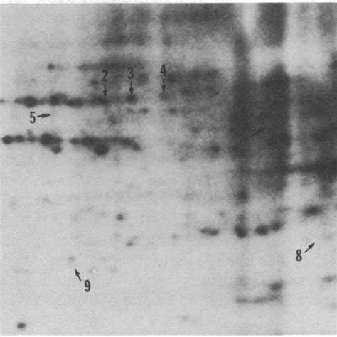 Two Dimensional Gel Electrophoresis Of 32p Labeled Proteins From Cho K1