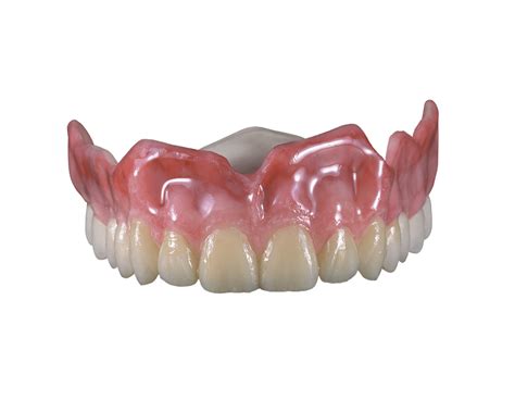 Flexcera™ Smile Ultra Carbon