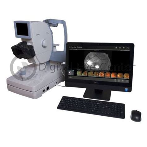 Canon Cr 1 Nm Fundus Camera Refurbished Dec