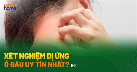 Tìm Hiểu Về Xét Nghiệm Dị ứng Thuốc Bao Nhiều Tiến Và Những điều Cần Biết