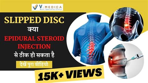 Lumbar Epidural Steroid Injection For Slipped Disc Dr Ashish Yadav