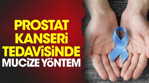 Prostat Kanseri Tedavisinde Mucize Y Ntem