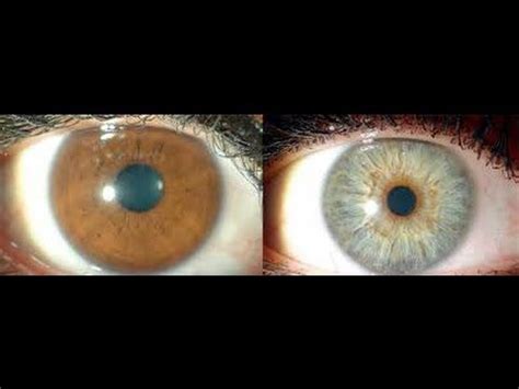 Se Puede Cambiar El Color De Los Ojos Naturalmente Consejos Ojos