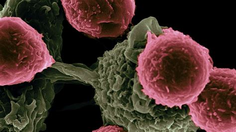 New cancer-fighting discovery identifies patients who respond better to ...