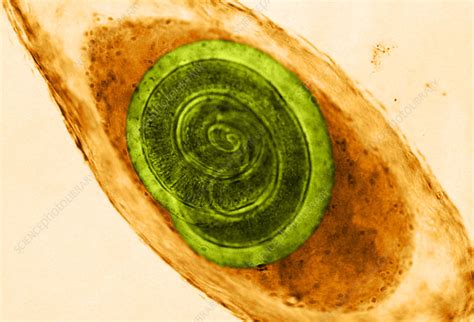 Trichinella in Muscle (LM) - Stock Image - C012/1322 - Science Photo ...