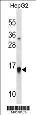 GMFB Antibody Cat No 60 556 ProSci