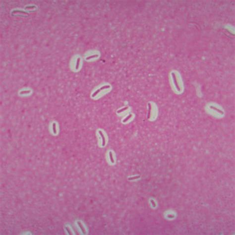 Prokaryote Slides | Carolina Biological Supply