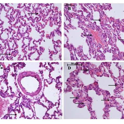 Light Microscopy Of The Lung Parenchyma Hhp Group A Moderate