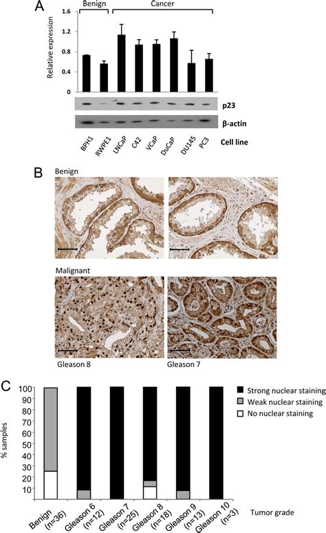 Expression Of P In Human Prostate Cell Lines And Tissue A Total