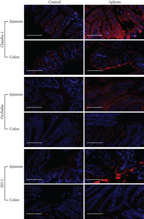 Expressions Of Tight Junction Related Proteins In Tissues Of The