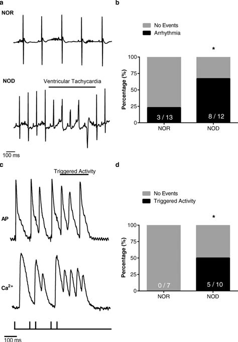 NOD mice have increased severity/susceptibility to ventricular ...