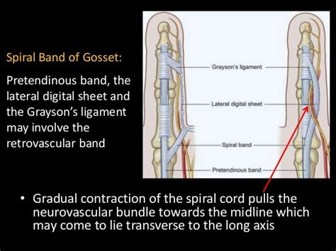 Dupuytrens Contracture