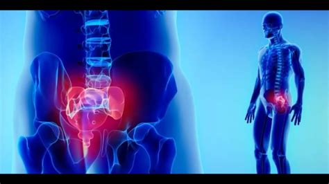 ABSCESO PERIRRECTAL ABSCESO PERIANAL CAUSAS SÍNTOMAS DATOS CLÍNICOS Y