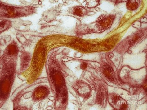 Borrelia Burgdorferi Lyme Disease Tem Photograph By David M Phillips