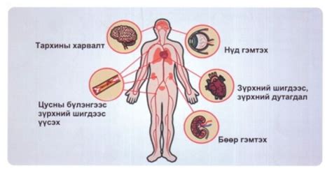 Цус алдалтын үед яах вэ :|: Сувилагчийн тухай