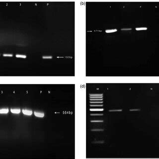 A Pcr Detection Of The V Cholerae O Specific Rfb O Gene Lane M