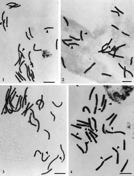 Feulgen Stained Metaphase Chromosomes Of Lilium Fig 1 L Candidum