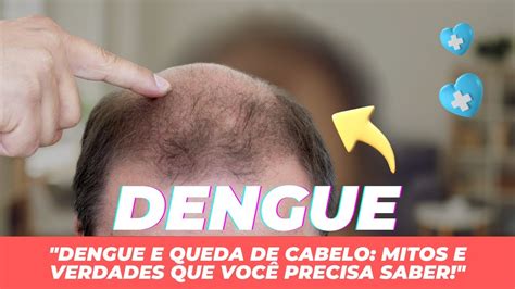 Dengue e Queda de Cabelo Mitos e Verdades que Você Precisa Saber YouTube