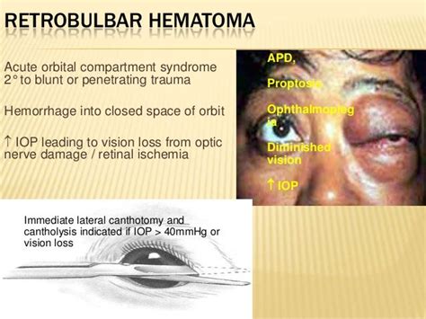 Common Ocular Emergencies