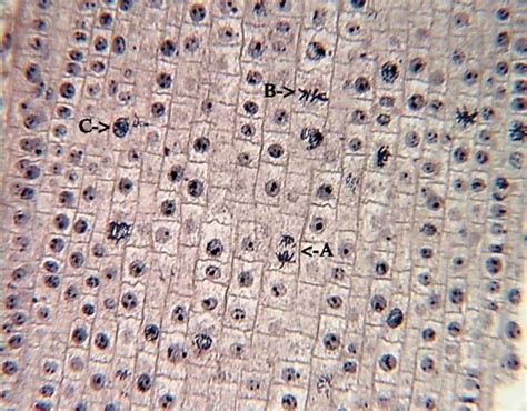 Onion Root Tip Mitosis Labeled Cellrepro Html Observing Onion Root