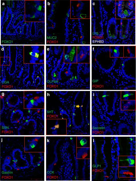 Survey Of Foxo Expression In The Human Duodenum Ae Foxo Red